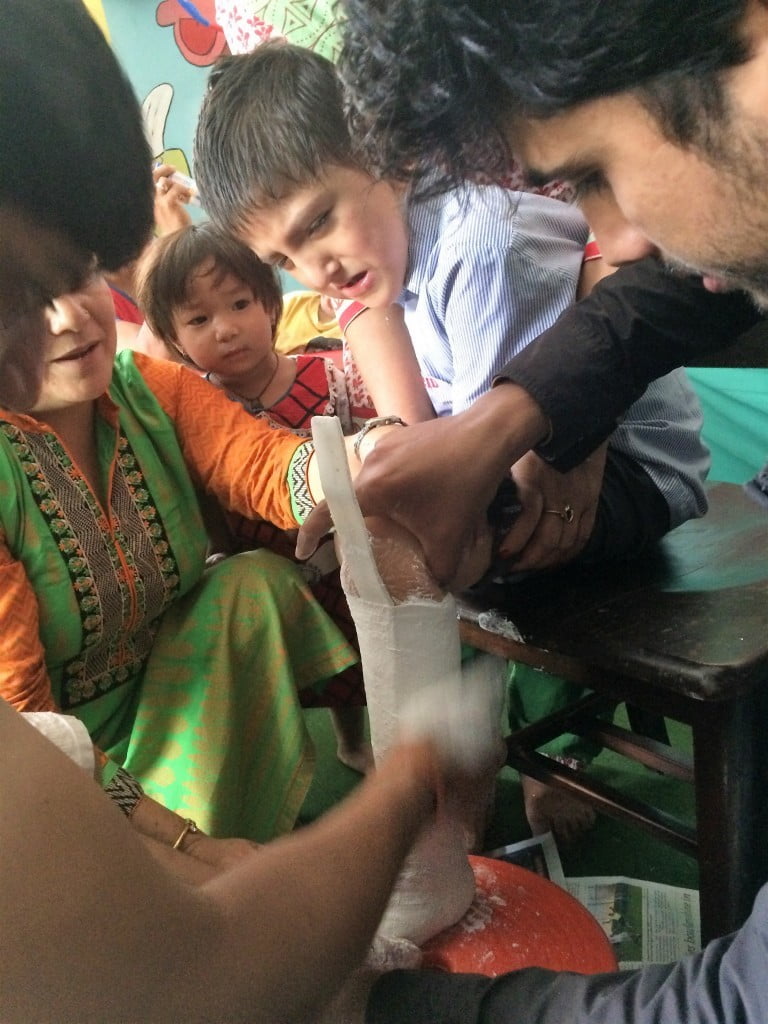 Therapists and students making a mold for a splint